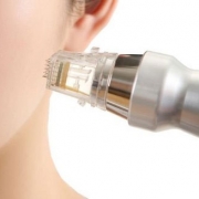 Mesotherapy-with-Micro-needling